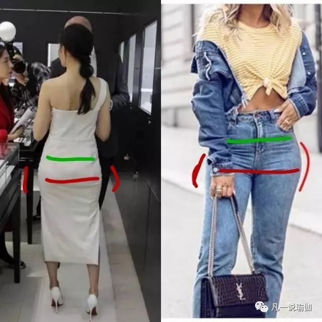 假胯寬可以做正骨糾正嗎_假胯寬可以做骨盆修復嗎_假胯寬可以用骨盆帶嗎