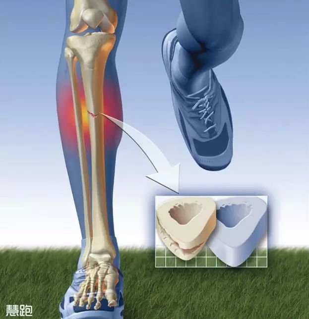 老左腳肌肉腿跳小是咋回事_左腳小腿跳動(dòng)_左腳小腿肌肉老是跳