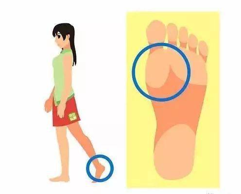 膝蓋走路直起來就疼_膝蓋直著走路_走路膝蓋應(yīng)該是直的嗎