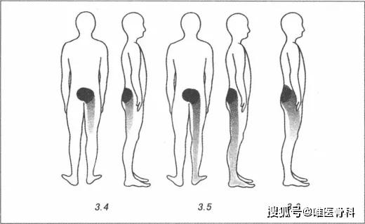 alterg反重力跑步機官網(wǎng)_國內(nèi)反重力跑步機_0重力跑步機