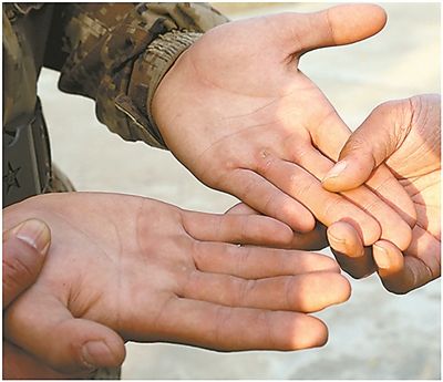 云開·全站APP登錄入口 榮譽(yù)勛章“手掌老繭” 做好3點(diǎn)手不再磨破出血！