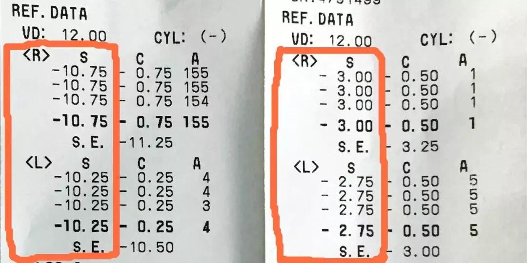 做視力訓(xùn)練有用嗎_視力訓(xùn)練有沒有用_視力訓(xùn)練一般做多長時間