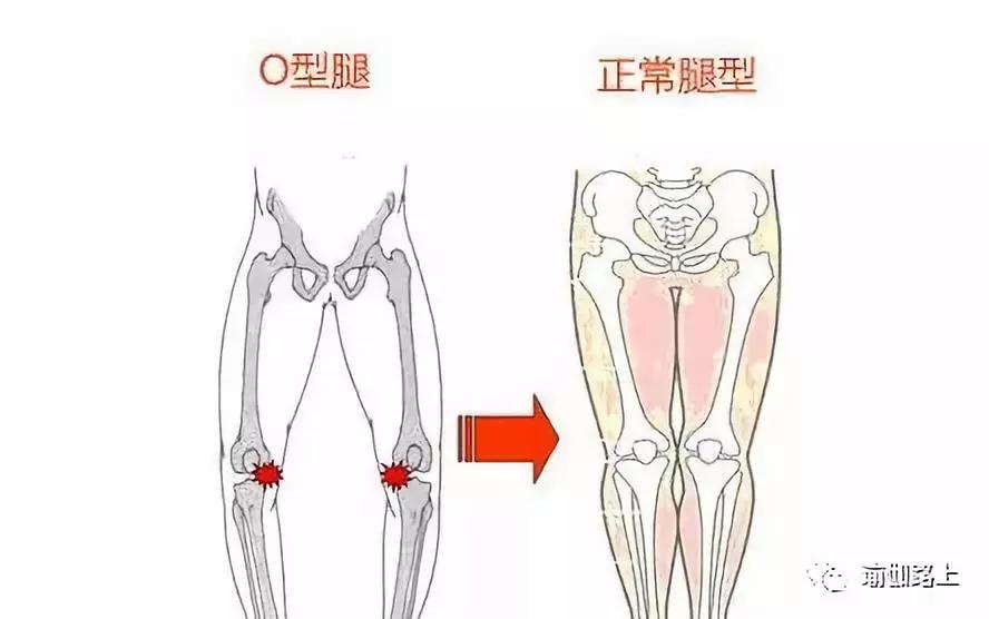 瑜伽改善腿型動作_改善x型腿的瑜伽_瑜伽腿型矯正