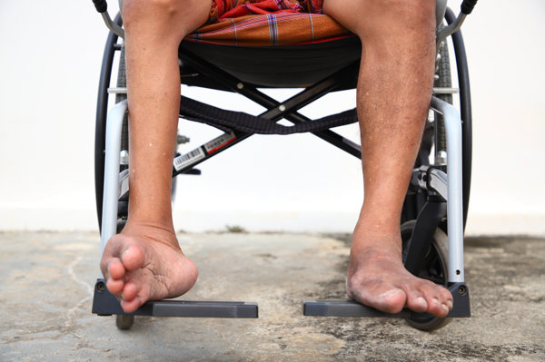 pg電子麻將胡了 二手腦癱下肢康復(fù)訓(xùn)練器材